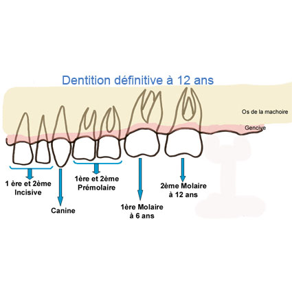 Dentition d'un enfant de 12 ans