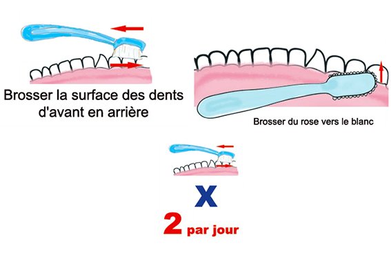 Imprimer les étapes du brossage des dents
