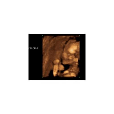 Tout au long du sixième mois de grossesse, les organes de votre bébé poursuivent leur développement et leur formation, que ce soit pour les dents