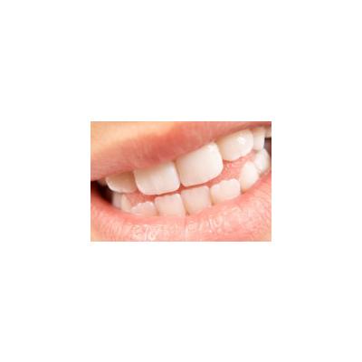 Dentition d'un enfant de 12 ans 