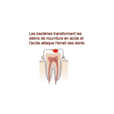 Les caries