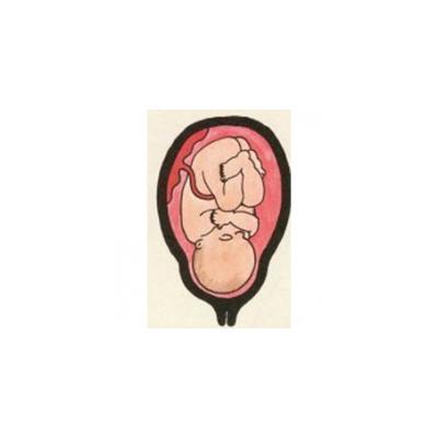 A 30 semaine votre bébé pèse environ 1,5 kg, il commence à s'arrondir et sa peau ne plisse plus. Sa peau beaucoup plus épaisse ne laisse plus voir que les gros vaisseaux, elle est de moins en moins ro