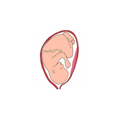 En principe la présentation de votre bébé sera connue avant le jour de l'accouchement. Bébé peut se présenter de différentes façons par la tête, la face, l'&
