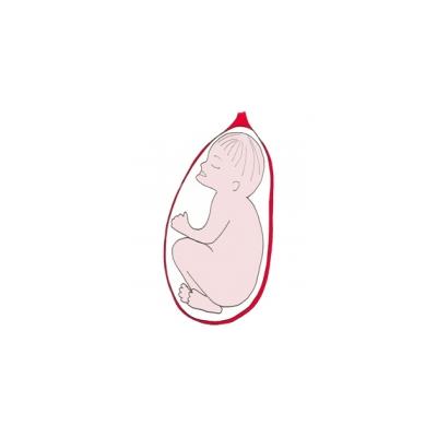 La présentation la face. Bébé se présente bien par la tête, mais la face en avant. Bébé présente la partie la plus large de sa tête. Cette présenta