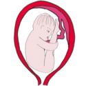 La présentation par le siège. Dans la présentation par le siège, bébé se présente les fesses les premières. Une présentation par le siège simple