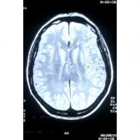 Où en est la formation du cerveau de bébé à 9 mois de grossesse ? Le cerveau et le système nerveux sont constitués et en état de marche. Le cerveau est suffisamment mature pour a