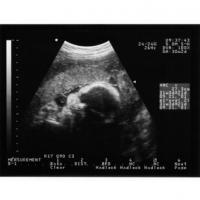Les organes poursuivent leur développement au cours du 5 ème mois de grossesse. Le corps de bébé termine sa construction, tous les organes ne sont pas arrivés à maturité, mais &a