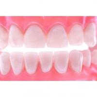 Les dents