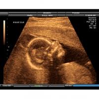 Au cours du 8 ème mois de grossesse votre bébé termine son développement. Il est presque mature et il doit se préparer pour sa grande entrée dans le monde que ce soit en prenant des forces 