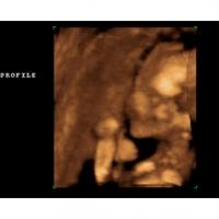 Tout au long du sixième mois de grossesse, les organes de votre bébé poursuivent leur développement et leur formation, que ce soit pour les dents