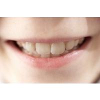 La dentition lactéale ou dents de lait
