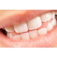 Dents de lait