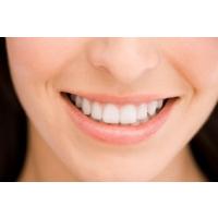 Belle dentition