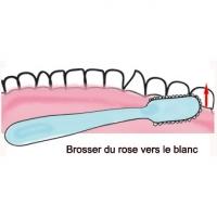 brossage des faces internes 