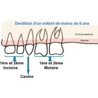 Dents de lait