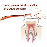 le brossage des dents 