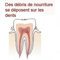 Manger fait augmenter l'acidité de la bouche 