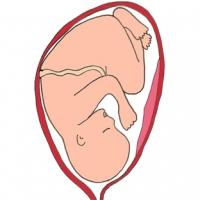 En principe la présentation de votre bébé sera connue avant le jour de l'accouchement. Bébé peut se présenter de différentes façons par la tête, la face, l'&
