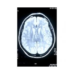 Où en est la formation du cerveau de bébé à 9 mois de grossesse ? Le cerveau et le système nerveux sont constitués et en état de marche. Le cerveau est suffisamment mature pour a