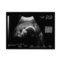 Les organes poursuivent leur développement au cours du 5 ème mois de grossesse. Le corps de bébé termine sa construction, tous les organes ne sont pas arrivés à maturité, mais &a