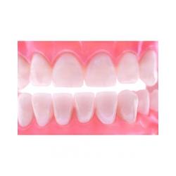 Les dents