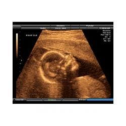 Au cours du 8 ème mois de grossesse votre bébé termine son développement. Il est presque mature et il doit se préparer pour sa grande entrée dans le monde que ce soit en prenant des forces 