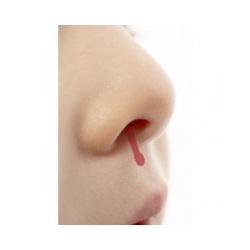 Beaucoup d'enfants saignent du nez sans que cela soit grave, mais en cas de saignements fréquents ou rapprochés, que faire, quelle conduite adopter ?
