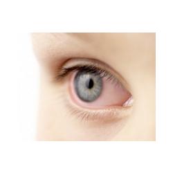 L'humeur aqueuse de l'oeil 