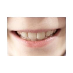 La dentition lactéale ou dents de lait