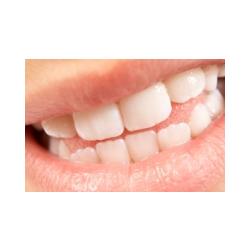 Dentition d'un enfant de 12 ans 