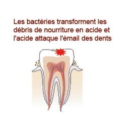 Les caries
