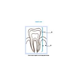 Activité sur la couronne et la racine de la dent - Planche anatomique