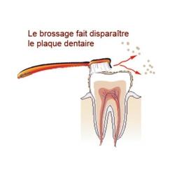 le brossage des dents 