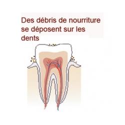 Manger fait augmenter l'acidité de la bouche 