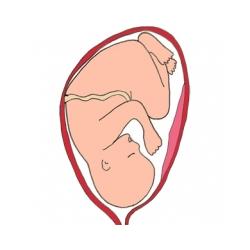 La présentation de bébé par la tête. La présentation habituelle du bébé est une présentation par la tête. Le bébé se présente