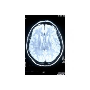 Où en est la formation du cerveau de bébé à 9 mois de grossesse ? Le cerveau et le système nerveux sont constitués et en état de marche. Le cerveau est suffisamment mature pour a