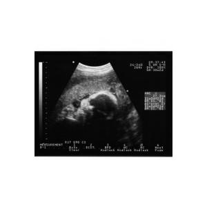 Les organes poursuivent leur développement au cours du 5 ème mois de grossesse. Le corps de bébé termine sa construction, tous les organes ne sont pas arrivés à maturité, mais &a