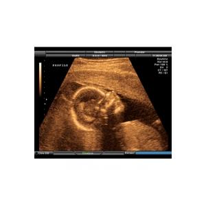 Au cours du 8 ème mois de grossesse votre bébé termine son développement. Il est presque mature et il doit se préparer pour sa grande entrée dans le monde que ce soit en prenant des forces 
