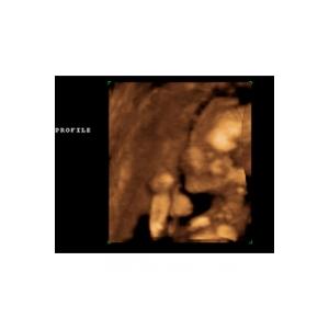 Tout au long du sixième mois de grossesse, les organes de votre bébé poursuivent leur développement et leur formation, que ce soit pour les dents