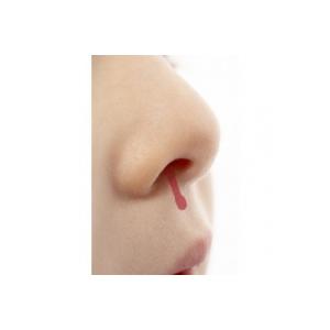 Beaucoup d'enfants saignent du nez sans que cela soit grave, mais en cas de saignements fréquents ou rapprochés, que faire, quelle conduite adopter ?
