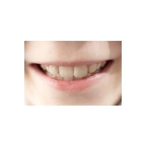 La dentition lactéale ou dents de lait