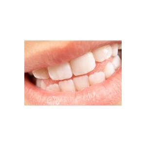 Les dents, la dentition