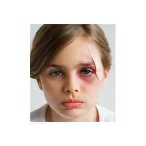 Comment soigner une blessure occulaire ? Que faire si mon enfant se blesse à l'oeil ? Les petites blessures aux yeux arrivent souvent en vacances et lors des jeux en plein air

