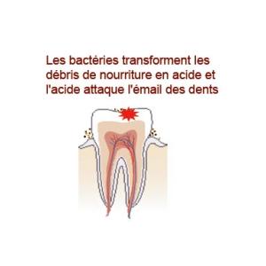 Les caries