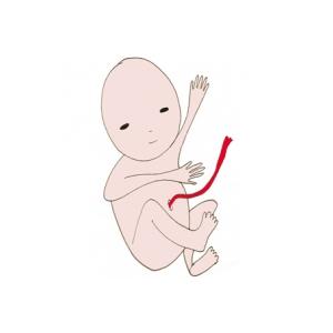 Les galipettes de bébé dans le ventre maman !