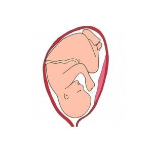 La présentation de bébé par la tête. La présentation habituelle du bébé est une présentation par la tête. Le bébé se présente