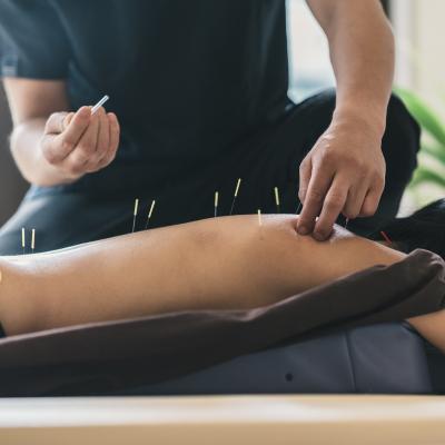 Acupuncture : Mot du glossaire Tête à modeler. Un acteur est une personne qui interprète un rôle au théâtre ou au cinéma.
