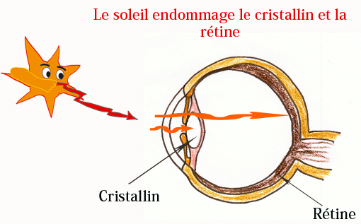 le soleil agresse l'oeil